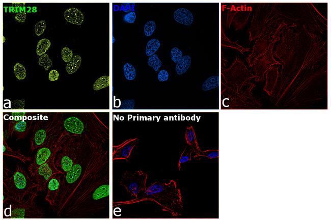 TRIM28 Antibody in Immunocytochemistry (ICC/IF)