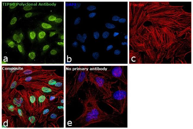 TIP60 Antibody in Immunocytochemistry (ICC/IF)