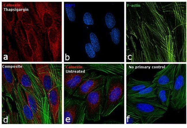 Calnexin Antibody in Immunocytochemistry (ICC/IF)