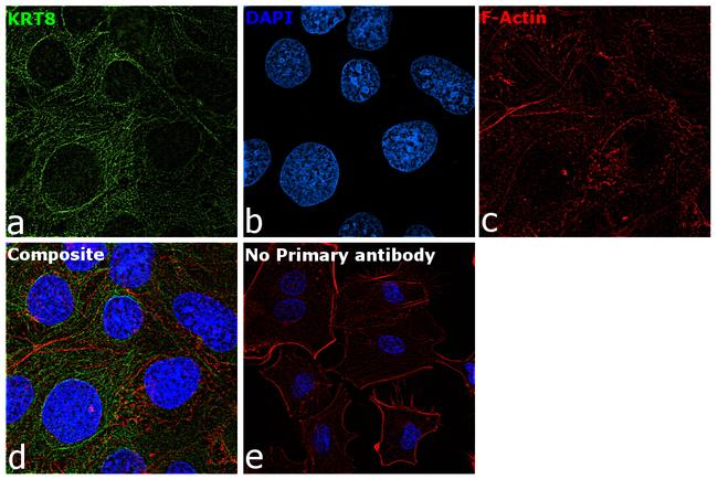 Cytokeratin 8 Antibody in Immunocytochemistry (ICC/IF)