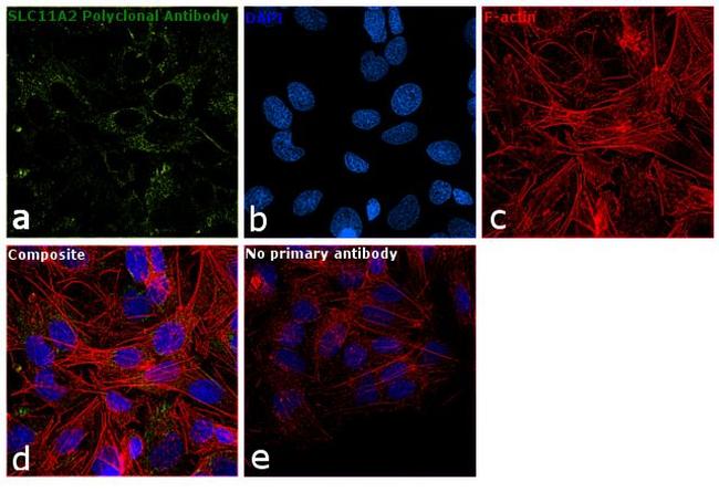 SLC11A2 Antibody in Immunocytochemistry (ICC/IF)