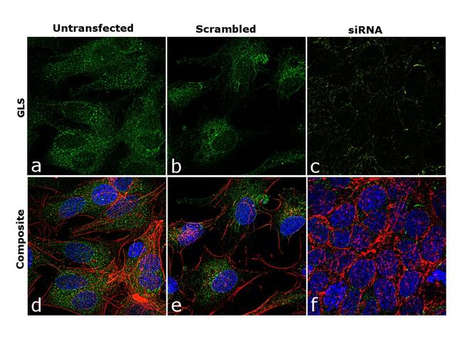 Glutaminase Antibody in Immunocytochemistry (ICC/IF)