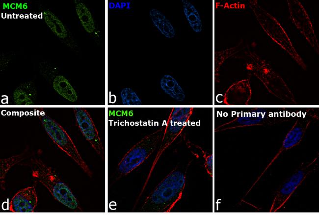 MCM6 Antibody in Immunocytochemistry (ICC/IF)