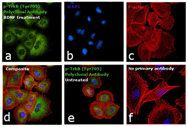 Phospho-TrkB (Tyr516) Antibody in Immunocytochemistry (ICC/IF)