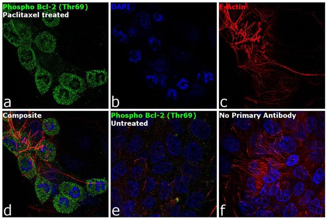 Phospho-Bcl-2 (Thr69) Antibody in Immunocytochemistry (ICC/IF)