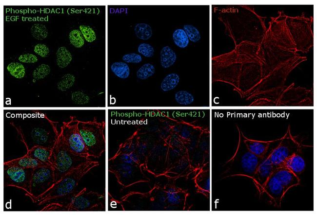 Phospho-HDAC1 (Ser421) Antibody in Immunocytochemistry (ICC/IF)