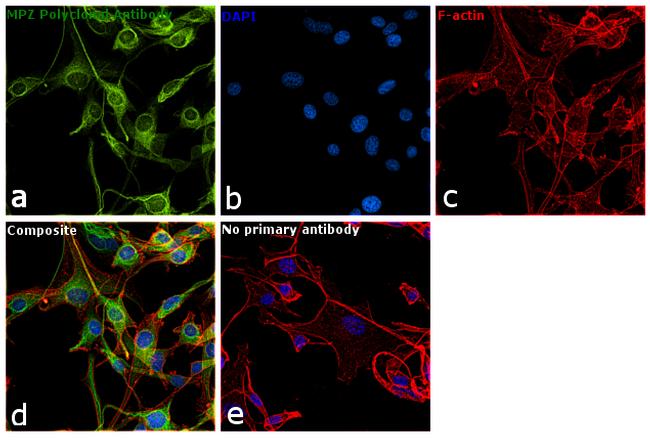 MPZ Antibody in Immunocytochemistry (ICC/IF)