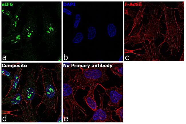 eIF6 Antibody in Immunocytochemistry (ICC/IF)