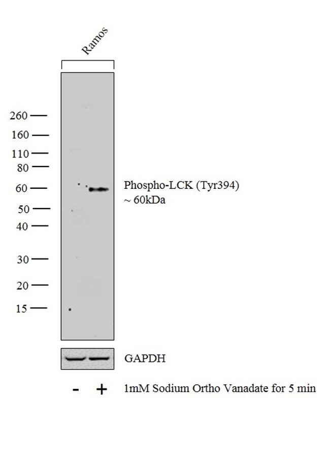 Phospho-LCK (Tyr394) Antibody in Western Blot (WB)