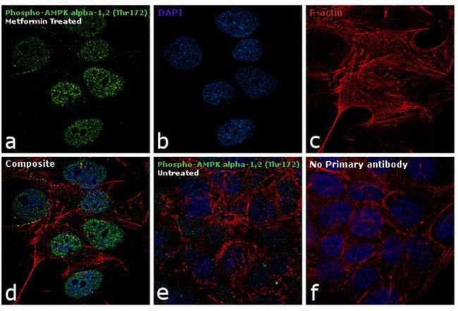 Phospho-AMPK alpha-1,2 (Thr172) Antibody in Immunocytochemistry (ICC/IF)