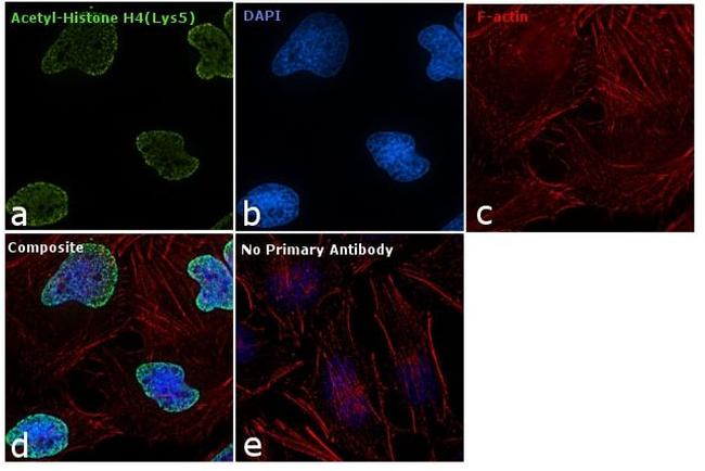 H4K5ac Antibody in Immunocytochemistry (ICC/IF)