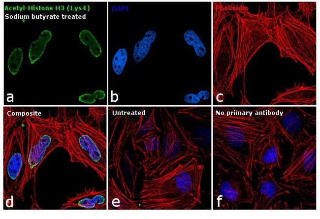 H3K4ac Antibody in Immunocytochemistry (ICC/IF)