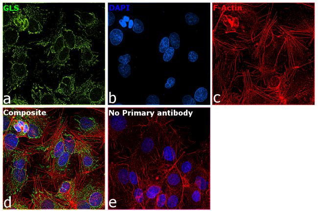 Glutaminase C (GAC) Antibody in Immunocytochemistry (ICC/IF)