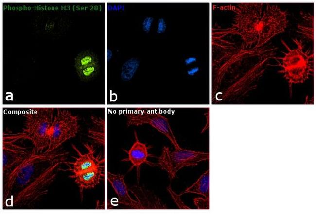 Phospho-Histone H3 (Ser28) Antibody in Immunocytochemistry (ICC/IF)