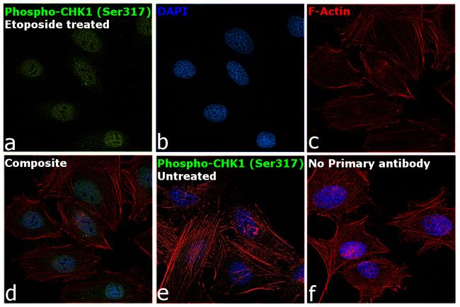 Phospho-CHK1 (Ser317) Antibody in Immunocytochemistry (ICC/IF)