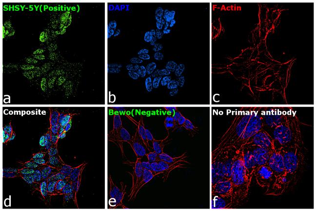 SOX11 Antibody in Immunocytochemistry (ICC/IF)