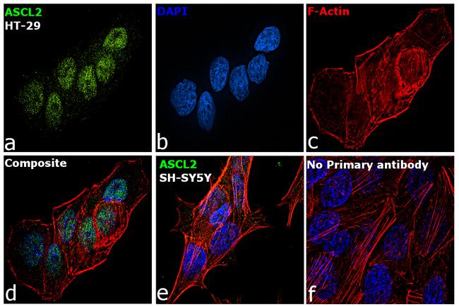 ASCL2 Antibody in Immunocytochemistry (ICC/IF)