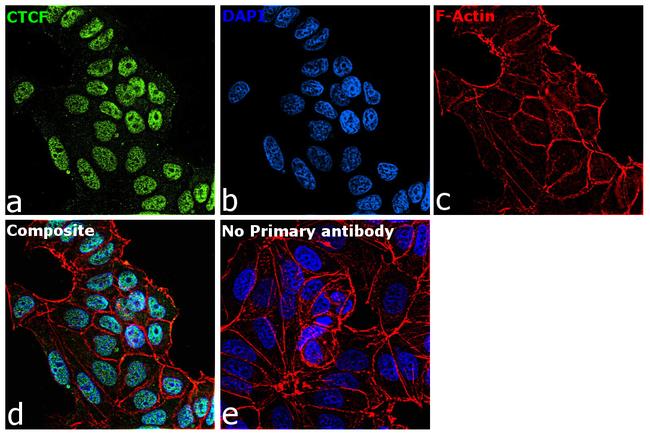 CTCF Antibody in Immunocytochemistry (ICC/IF)