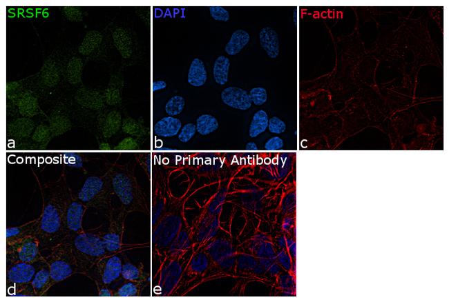 SRSF6 Antibody in Immunocytochemistry (ICC/IF)