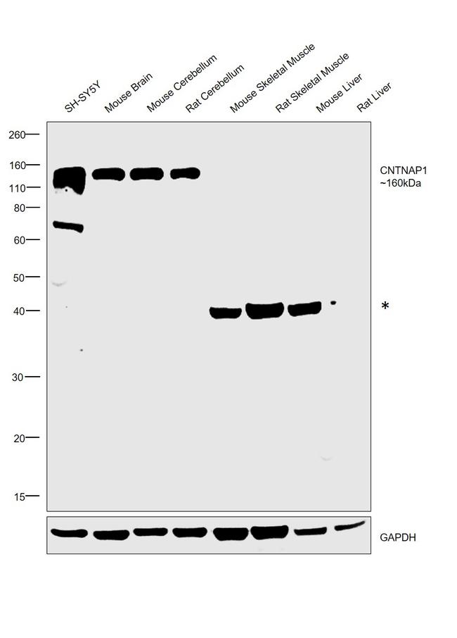 CNTNAP1 Antibody in Western Blot (WB)