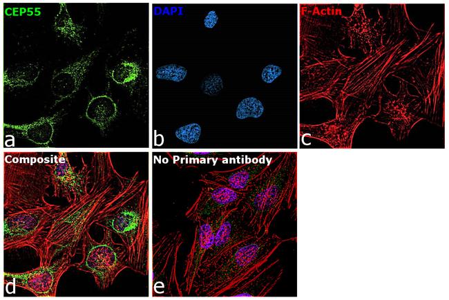 CEP55 Antibody in Immunocytochemistry (ICC/IF)