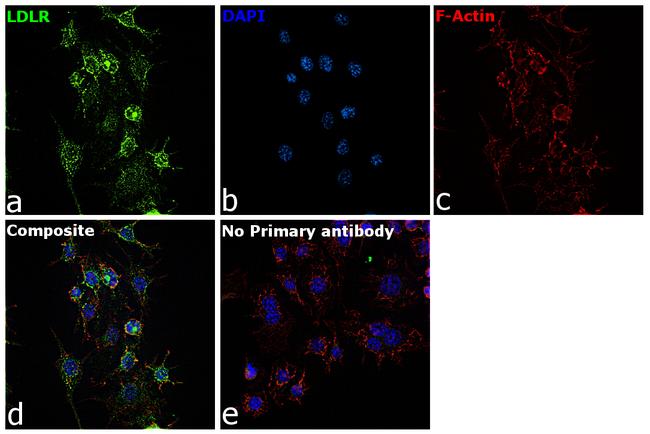 LDLR Antibody in Immunocytochemistry (ICC/IF)