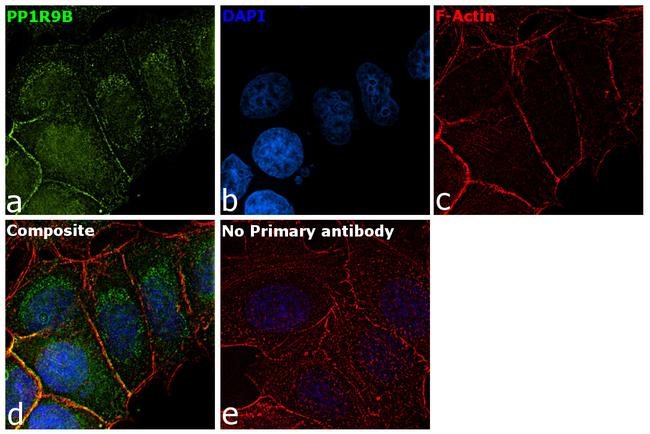 PPP1R9B Antibody in Immunocytochemistry (ICC/IF)