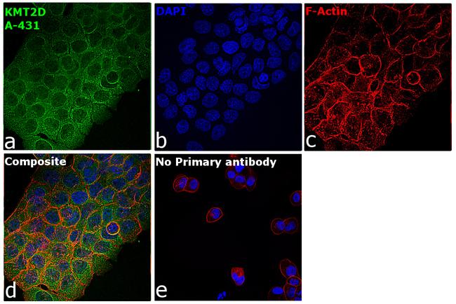 KMT2D Antibody in Immunocytochemistry (ICC/IF)