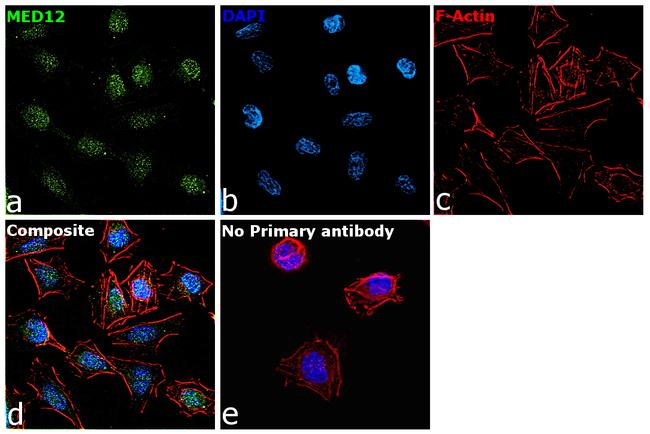 MED12 Antibody in Immunocytochemistry (ICC/IF)