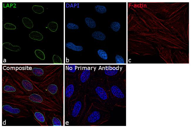 LAP2 Antibody in Immunocytochemistry (ICC/IF)