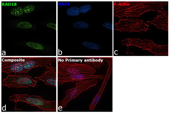 RAD18 Antibody in Immunocytochemistry (ICC/IF)