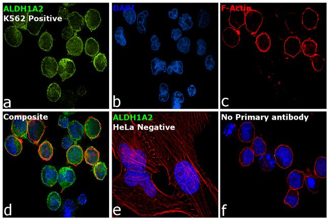 ALDH1A2 Antibody in Immunocytochemistry (ICC/IF)