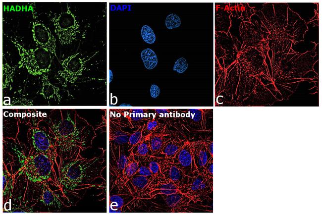 HADHA Antibody in Immunocytochemistry (ICC/IF)