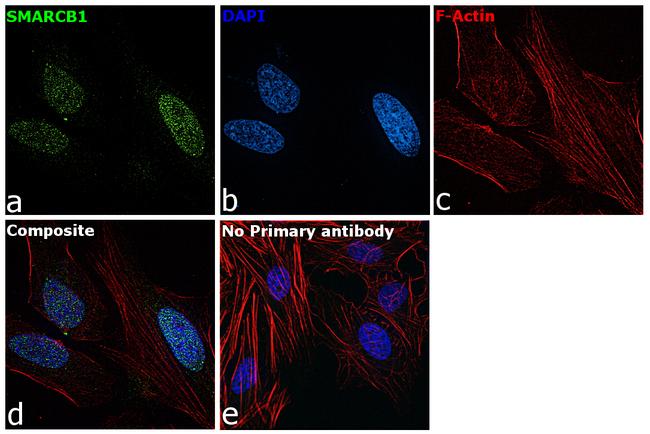 SMARCB1 Antibody in Immunocytochemistry (ICC/IF)