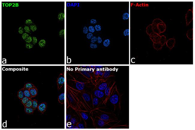 TOP2B Antibody in Immunocytochemistry (ICC/IF)