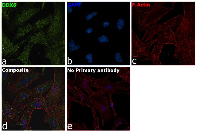 DDX6 Antibody in Immunocytochemistry (ICC/IF)