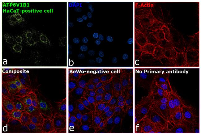 ATP6V1B1 Antibody in Immunocytochemistry (ICC/IF)