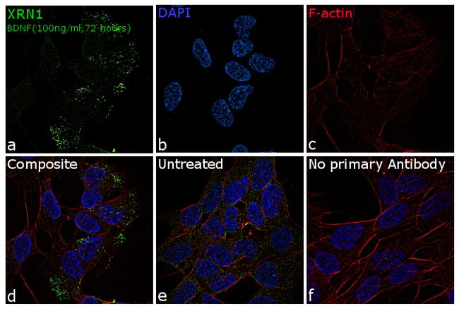 XRN1 Antibody in Immunocytochemistry (ICC/IF)