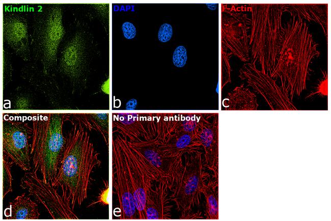 Kindlin 2 Antibody in Immunocytochemistry (ICC/IF)