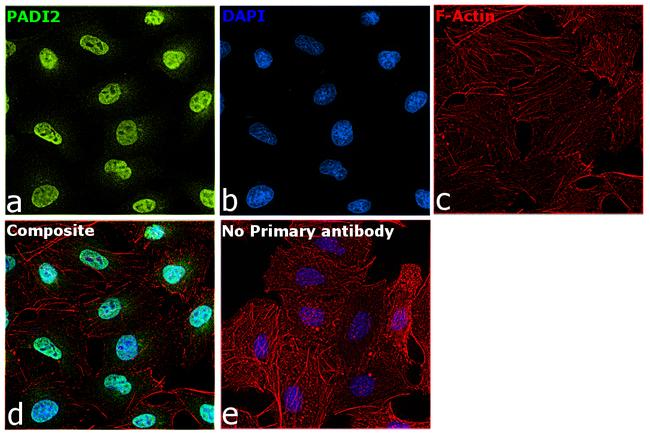 PADI2 Antibody in Immunocytochemistry (ICC/IF)