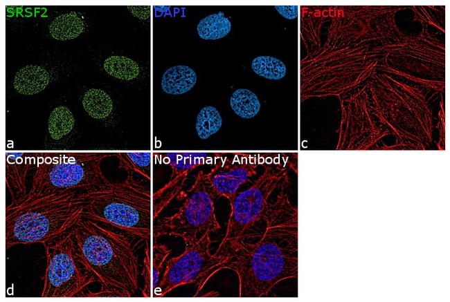 SRSF2 Antibody in Immunocytochemistry (ICC/IF)