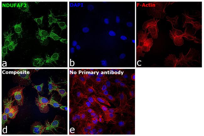 NDUFAF2 Antibody in Immunocytochemistry (ICC/IF)