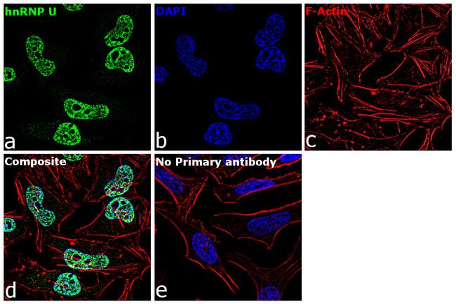 hnRNP U Antibody in Immunocytochemistry (ICC/IF)