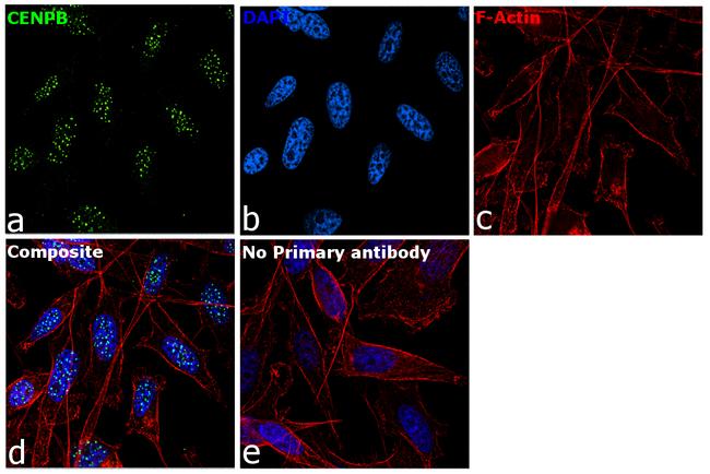 CENPB Antibody in Immunocytochemistry (ICC/IF)