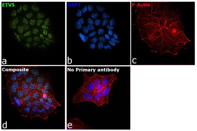 ETV5 Antibody in Immunocytochemistry (ICC/IF)