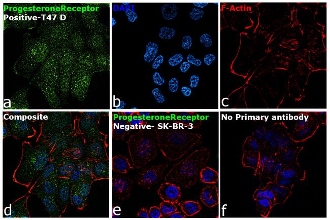 Progesterone Receptor Antibody in Immunocytochemistry (ICC/IF)