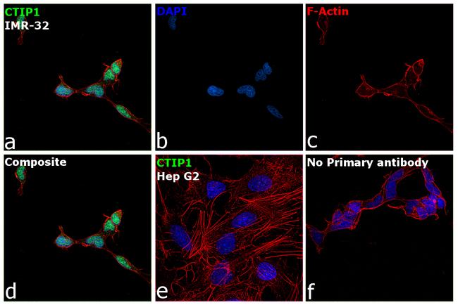 BCL11A Antibody in Immunocytochemistry (ICC/IF)