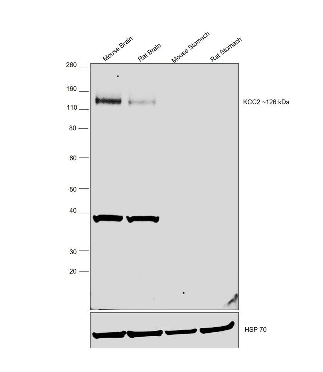 KCC2 Antibody in Western Blot (WB)