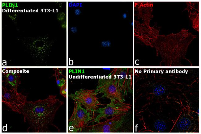 Perilipin 1 Antibody in Immunocytochemistry (ICC/IF)