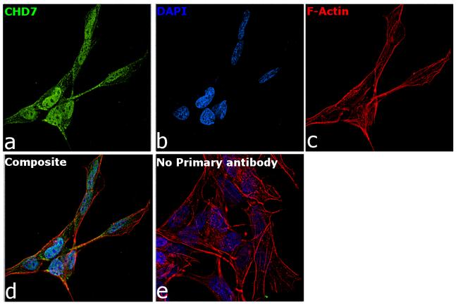 CHD7 Antibody in Immunocytochemistry (ICC/IF)